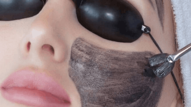 Picosecond Laser vs. Q-Switched Laser Which Is Better for Tattoos and Pigmentation