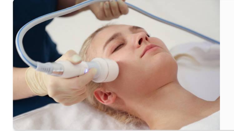 Does RF Microneedling Work for Acne Scars Results, Sessions, and a Clinic Guide