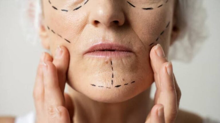 HIFU Before and After by Age： What Results Can You Expect in Your 30s, 40s and 50s？
