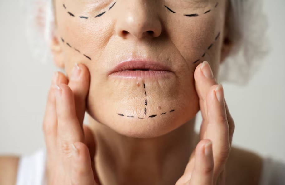 HIFU vs RF Skin Tightening: Differences, Results, and Ideal Treatment Candidates- HIFU vs RF Skin Tightening: Differences, Results, and Ideal Treatment Candidates-