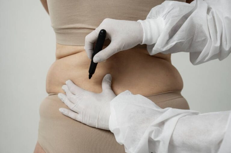 Non-Invasive Body Contouring Trends in 2026 Why Clinics Are Investing in Multi-Technology Machines
