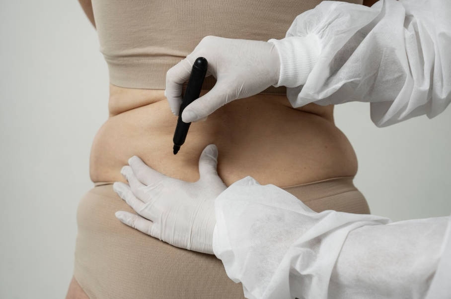 Non-Invasive Body Contouring Trends in 2026: Why Clinics Are Investing in Multi-Technology Machines- Non-Invasive Body Contouring Trends in 2026: Why Clinics Are Investing in Multi-Technology Machines-
